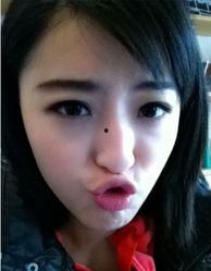 央视女主播的揪痧照片